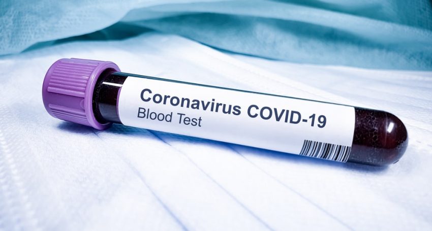The number of coronavirus cases in Cyprus has surpassed 20,000