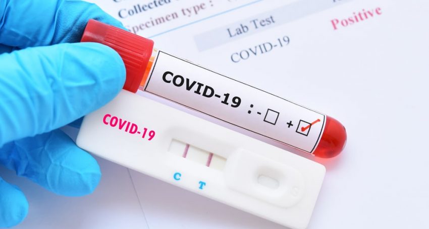 Cypriots were the most active in Europe in taking COVID-19 tests